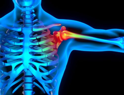 Can Chiropractic Care Help With Frozen Shoulder?