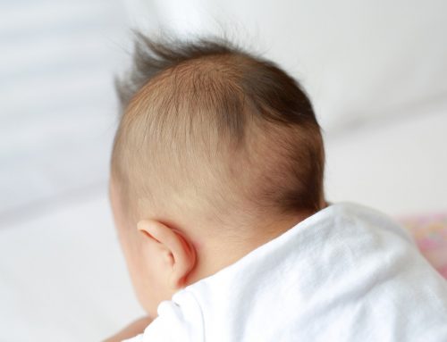 Plagiocephaly: Understanding and Preventing Flat Spots on Your Baby’s Head
